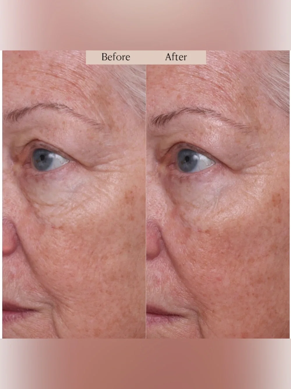Nakery Beauty SkinRepair Retinol Deep Wrinkle Serum- firming, lifting, smoothing